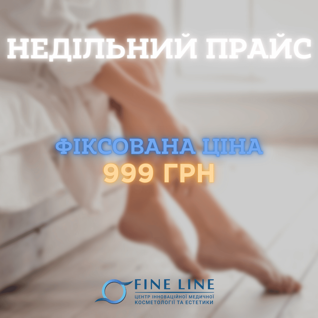 ФІКСОВАНА ЦІНА